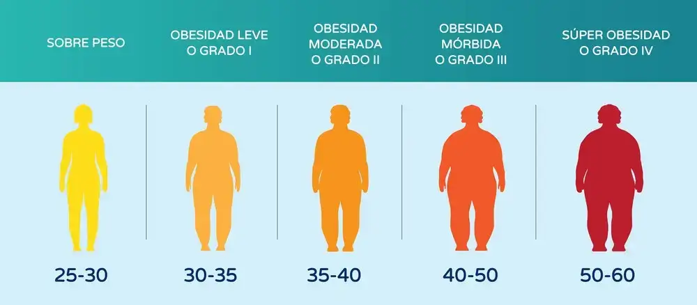 Obesidad en cuenca