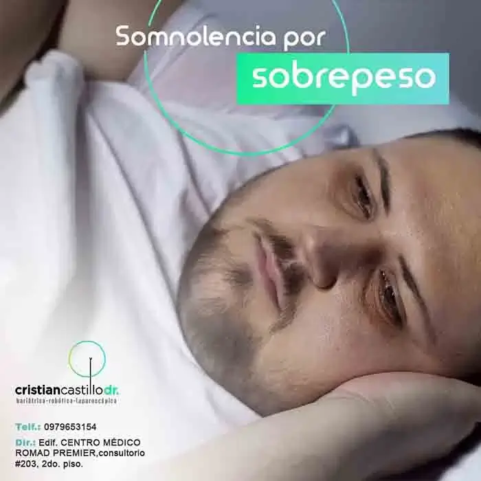 Somnolencia por Sobrepeso en Cuenca